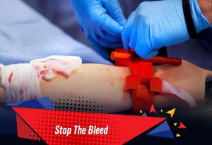 Stop The Bleed